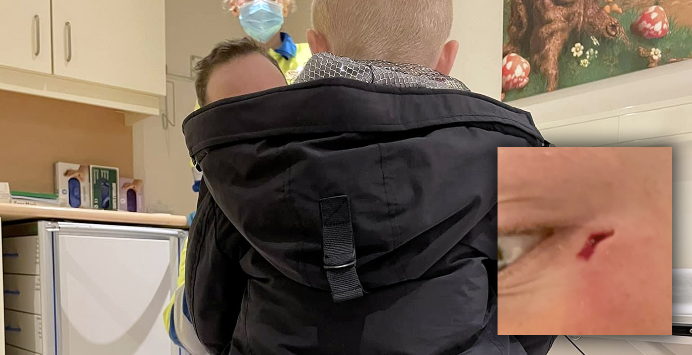 Man geeft Efteling de schuld van ongeluk met tafel: 'Blijvend letsel'